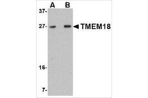 Western blot analysis of TMEM18 in rat brain lysate with TMEM18 antibody at (A) 0. (Transmembrane Protein 18 (TMM18) (C-Term) anticorps)