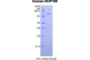SDS-PAGE analysis of Human Nucleoporin 188 kDa Protein. (NUP188 Protéine)