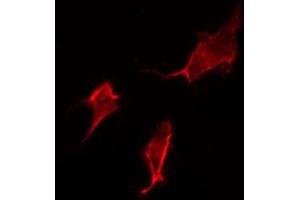 ABIN6277355 staining HepG2 by IF/ICC. (Dopamine Receptor d1 anticorps  (N-Term))