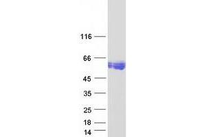 Validation with Western Blot