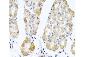 Immunohistochemistry of paraffin-embedded Human stomach using MRPL11 Polyclonal Antibody at dilution of 1:100 (40x lens). (MRPL11 anticorps)