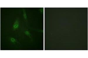 Immunofluorescence analysis of HeLa cells, using NFAT4 (Phospho-Ser165) Antibody. (NFATC3 anticorps  (pSer165))