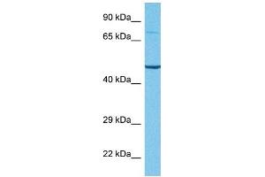 Host:  Rabbit  Target Name:  TNFRSF1A  Sample Tissue:  Human Jurkat Whole Cell  Antibody Dilution:  1ug/ml