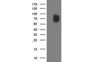 Western Blotting (WB) image for anti-Interferon Regulatory Factor 6 (IRF6) antibody (ABIN1498903)