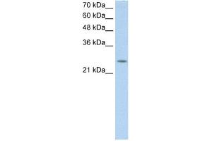 WB Suggested Anti-C5orf4 Antibody Titration:  0. (C5ORF4 anticorps  (N-Term))