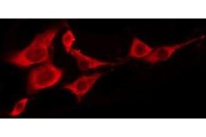 ABIN6276227 staining LOVO by IF/ICC. (TAS2R5 anticorps  (Internal Region))