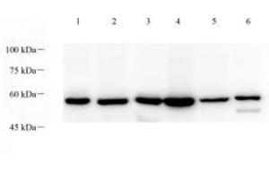 Western blot analysis of p38IP (ABIN7075954) at dilution of 1: 1000,Lane 1: Mouse testis tissue lysate,Lane 2: Mouse thymus tissue lysate,Lane 3: Mouse lung tissue lysate,Lane 4: Rat testis tissue lysate,Lane 5: Rat thymus tissue lysate,Lane 6: Rat lung tissue lysate (Transcription Factor SPT20 Homolog (SUPT20H) anticorps)