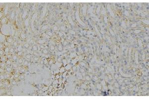 ABIN6276781 at 1/100 staining Human gastric tissue by IHC-P. (HMGCR anticorps  (N-Term))