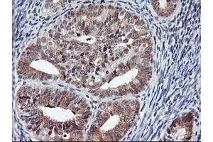 Image no. 5 for anti-Ubiquitin Specific Peptidase 10 (USP10) antibody (ABIN1501688)