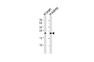 All lanes : Anti-FGF9 Antibody at 1:4000 dilution Lane 1: human brain lysates Lane 2: human kidney lysates Lysates/proteins at 20 μg per lane. (FGF9 anticorps)