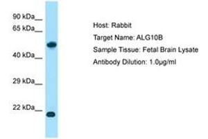 Image no. 1 for anti-Asparagine-Linked Glycosylation 10, alpha-1,2-Glucosyltransferase Homolog B (ALG10B) (AA 104-153) antibody (ABIN6750148) (ALG10B anticorps  (AA 104-153))