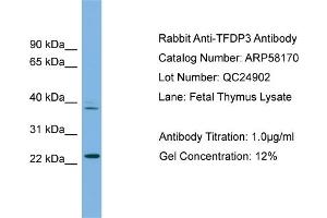 WB Suggested Anti-TFDP3  Antibody Titration: 0.