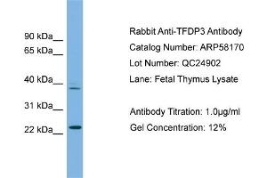 WB Suggested Anti-TFDP3  Antibody Titration: 0. (TFDP3 anticorps  (N-Term))