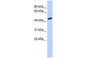 WARS antibody used at 1 ug/ml to detect target protein. (WARS anticorps  (N-Term))