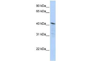 HDAC11 antibody used at 1 ug/ml to detect target protein.