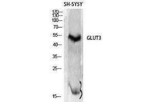Western Blotting (WB) image for anti-Solute Carrier Family 2 (Facilitated Glucose Transporter), Member 3 (SLC2A3) (C-Term) antibody (ABIN3184811) (SLC2A3 anticorps  (C-Term))