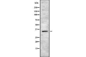 Western blot analysis SOX12 using COLO205 whole cell lysates (SOX12 anticorps  (Internal Region))