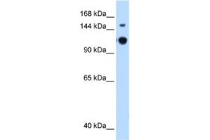GAPVD1 antibody used at 0. (GAPVD1 anticorps  (N-Term))