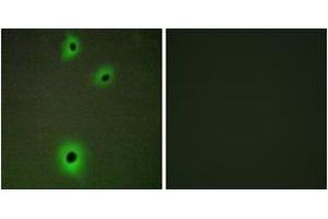 Immunofluorescence analysis of A549 cells, using CADM4 Antibody. (Cell Adhesion Molecule 4 anticorps  (AA 339-388))