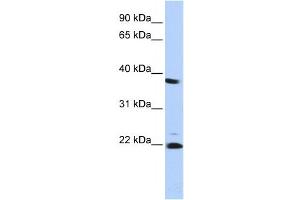 Western Blotting (WB) image for anti-Proteasome (Prosome, Macropain) Subunit, beta Type 2 (PSMB2) antibody (ABIN2459969) (PSMB2 anticorps)