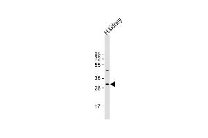 Anti-NRIP2 Antibody (Center) at 1:1000 dilution + human kidney lysate Lysates/proteins at 20 μg per lane. (NRIP2 anticorps  (AA 91-119))