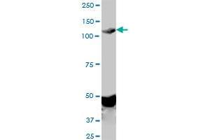 EPHA2 monoclonal antibody (M02), clone 1E3.