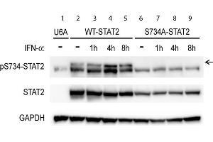Western Blot of Rabbit anti-STAT2pS734 antibody. (STAT2 anticorps  (C-Term, pSer734))