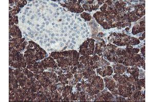 Image no. 2 for anti-Carboxypeptidase A1 (Pancreatic) (CPA1) antibody (ABIN1497589) (CPA1 anticorps)