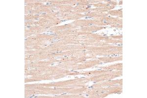 Immunohistochemistry of paraffin-embedded rat heart using ABCB7 antibody (ABIN6291732) at dilution of 1:100 (40x lens). (ABCB7 anticorps)