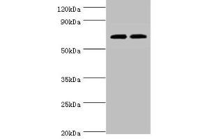 Western blot All lanes: APBB1IP antibody at 4 μg/mL Lane 1: HL60 whole cell lysate Lane 2: Rat spleen tissue Secondary Goat polyclonal to rabbit IgG at 1/10000 dilution Predicted band size: 74, 19 kDa Observed band size: 74 kDa (Amyloid beta (A4) Precursor Protein-Binding, Family B, Member 1 Interacting Protein (APBB1IP) (AA 1-150) anticorps)