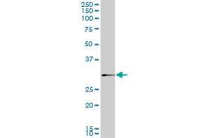 SIX3 monoclonal antibody (M02), clone 3F1. (SIX3 anticorps  (AA 273-332))