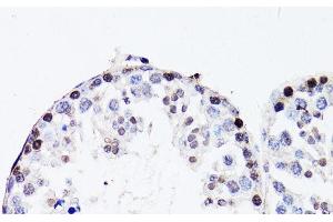 Immunohistochemistry of paraffin-embedded Mouse testis using FGF12 Polyclonal Antibody at dilution of 1:150 (40x lens). (FGF12 anticorps)