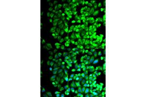 Immunofluorescence analysis of HeLa cells using TBXAS1 antibody. (TBXAS1 anticorps)