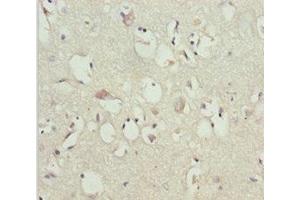Immunohistochemistry of paraffin-embedded human brain tissue using ABIN7153645 at dilution of 1:100 (GAS2L1 anticorps  (AA 130-400))