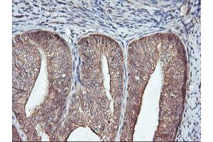 Image no. 10 for anti-F-Box Protein 21 (FBXO21) antibody (ABIN1498234)