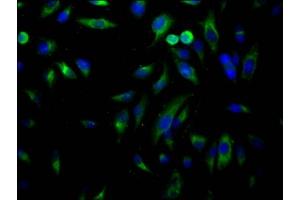 Immunofluorescence staining of Hela Cells with ABIN7127535 at 1:50, counter-stained with DAPI.