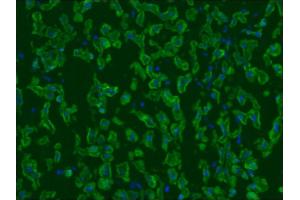 Image no. 2 for anti-Keratin 5/8 (KRT5/8) antibody (ABIN335325) (Keratin 5/8 anticorps)