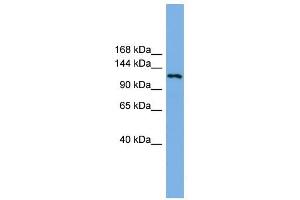 EIF4ENIF1 antibody used at 1 ug/ml to detect target protein.