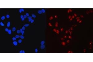 IF analysis of SP1 using anti-SP1 antibody (ABIN7601559).