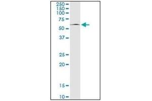 Western Blotting (WB) image for anti-Mitogen-Activated Protein Kinase 8 (MAPK8) antibody (ABIN953306)