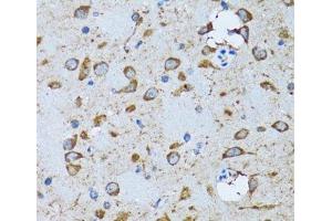 Immunohistochemistry of paraffin-embedded Mouse brain using PDP1 Polyclonal Antibody at dilution of 1:100 (40x lens). (PDP anticorps)