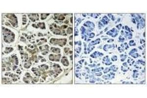 Immunohistochemistry analysis of paraffin-embedded human pancreas tissue using ATP5G2 antibody. (ATP5G2 anticorps)