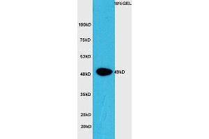 Lane 1: Mouse intestine lysate probed with Rabbit Anti-CTBP1 (Ser422) Polyclonal Antibody, Unconjugated (ABIN1386488) at 1:300 overnight at 4 °C. (CTBP1 anticorps  (pSer422))