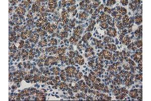 Image no. 6 for anti-Catenin (Cadherin-Associated Protein), beta 1, 88kDa (CTNNB1) antibody (ABIN1496888)