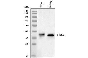 Western blot analysis of SIRT2 using anti-SIRT2 antibody (ABIN3043924).