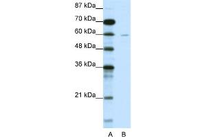 WB Suggested Anti-DCP1A Antibody Titration:  1. (DCP1A anticorps  (N-Term))