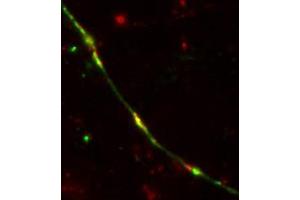 Image no. 3 for anti-TEV (Cut Protease Site) antibody (ABIN1742525) (TEV (Cut Protease Site) anticorps)