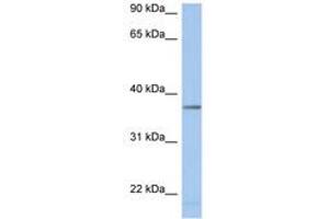 Image no. 1 for anti-Lactate Dehydrogenase A-Like 6B (LDHAL6B) (AA 251-300) antibody (ABIN6743763)