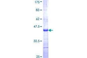 Image no. 1 for Eppin (SPINLW1) (AA 22-133) protein (GST tag) (ABIN1321195)