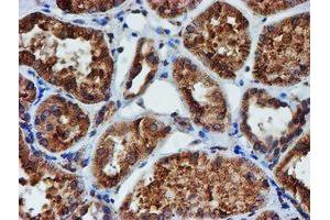 Image no. 9 for anti-Protein Disulfide Isomerase Family A, Member 4 (PDIA4) antibody (ABIN1500110)